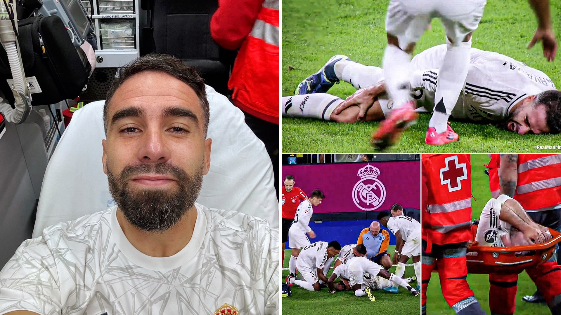 阿尔法队主力中场受伤，对球队影响较大的简单介绍